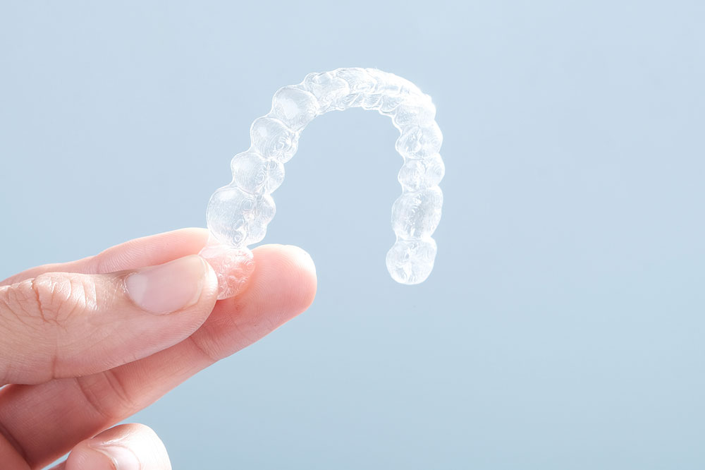 5 Advantages of Wearing Clear Braces