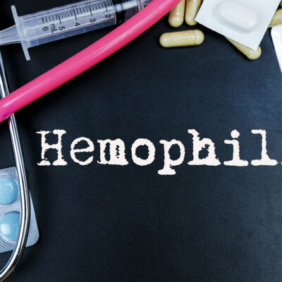 5 Early Warning Signs of Hemophilia